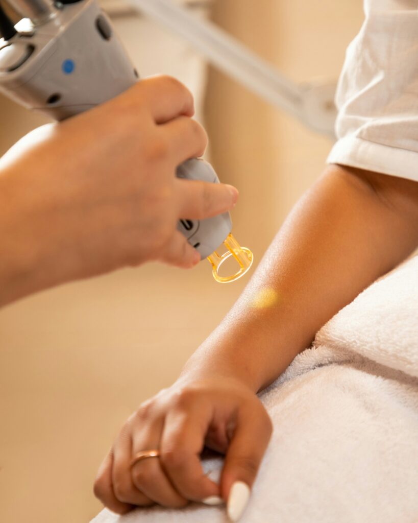 Laser usage for bride is very important to reduce hair growth and fine lines.