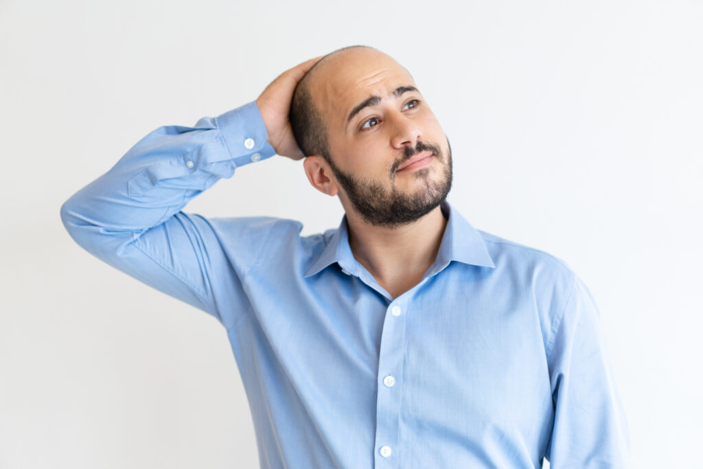 Hair loss is a problem which more than 80% of men have, and it has several reasons.