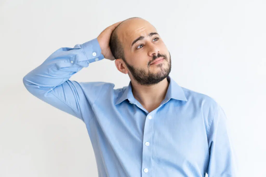 Hair loss is a problem which more than 80% of men have, and it has several reasons.